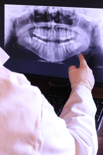 Best Emergency Dental Extractions in Andalusia, IL