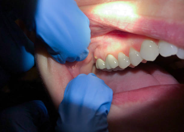 Best Urgent Dental Care for Toothache in Andalusia, IL